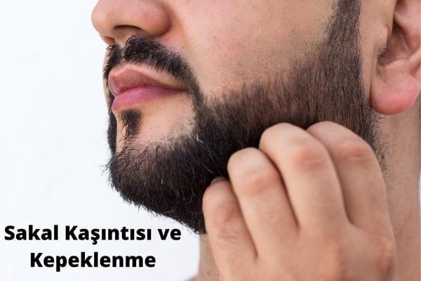 Sakal Kaşıntısı ve Sakal Kepeklenmesi Nasıl Giderilir?