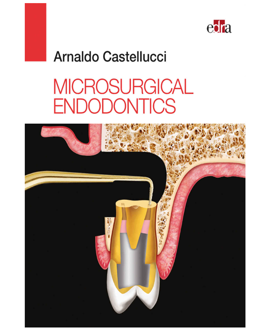 Microsurgical Endodontics