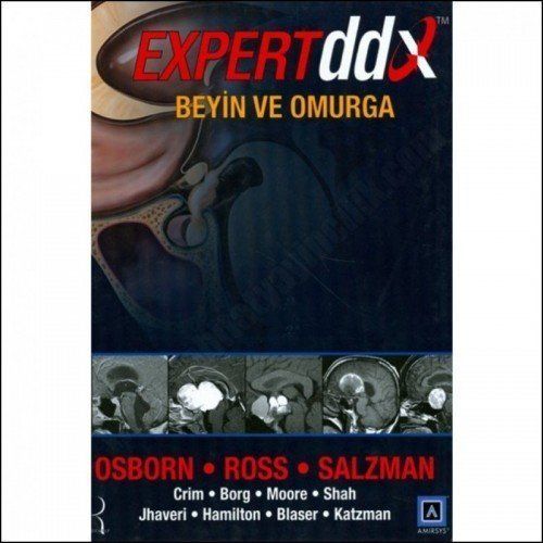 Osborn, Expert DDX: Beyin ve Omurga