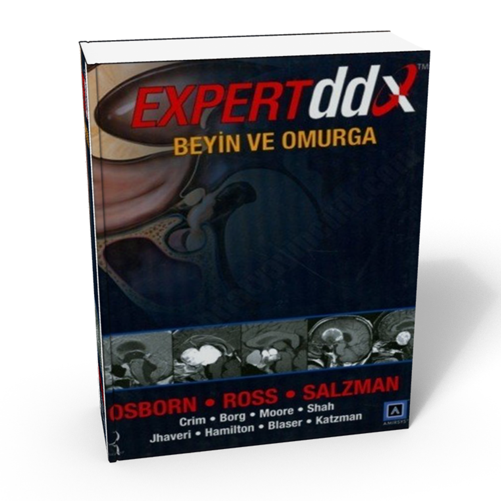 Osborn, Expert DDX: Beyin ve Omurga