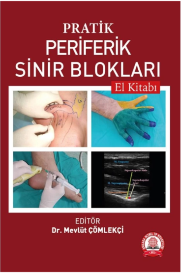 Pratik Periferik Sinir Blokları El Kitabı