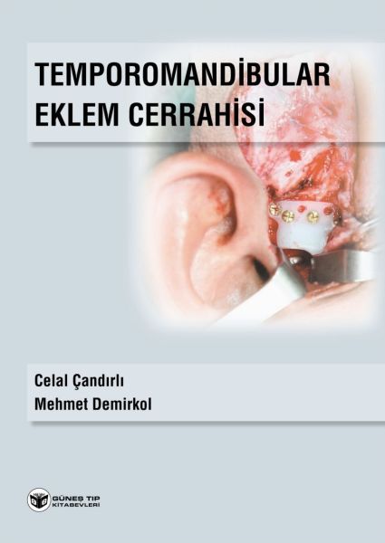 Temporomandibular Eklem Cerrahisi