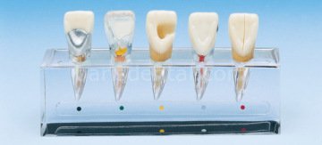 Hasta Eğitim Modeli/Endodonti