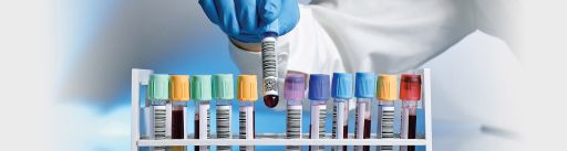 Laboratuvar & Kan Bankası Etiketleri