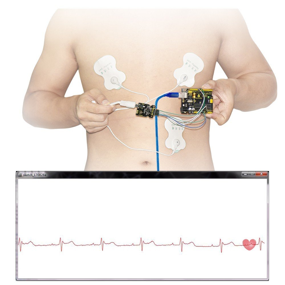 Keyestudio AD8232 EKG Ölçüm Kalp Monitörü Sensör Modülü / UNO R3 İçin