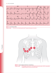 EKG'yi Anlamak (Uygulamalı Kılavuz)