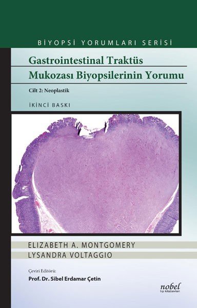 Gastrointestinal Traktüs Mukozası Biyopsilerinin Yorumu Cilt 2: Neoplastik - Biyopsi Yorumları Serisi