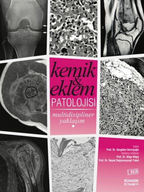 Kemik ve Eklem Patolojisi Multidisipliner Yaklaşım (Karton Kapak 2.baskı)