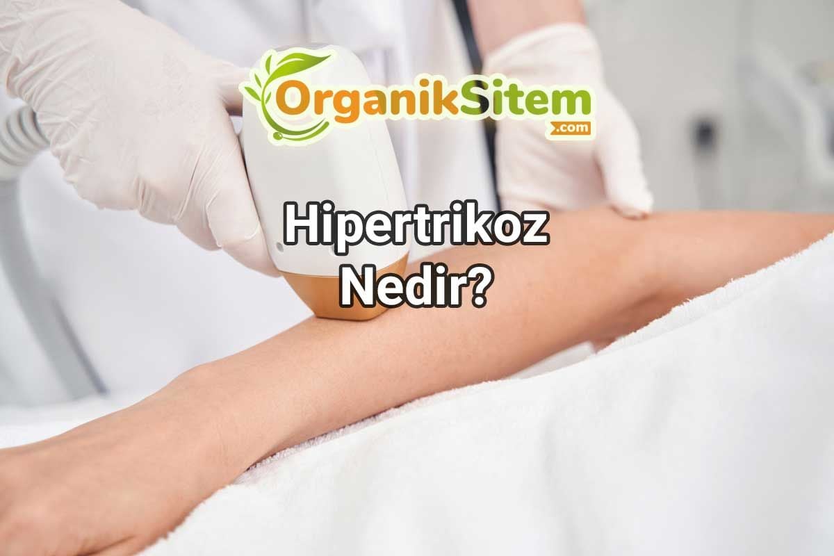 Hipertrikoz Nedir?