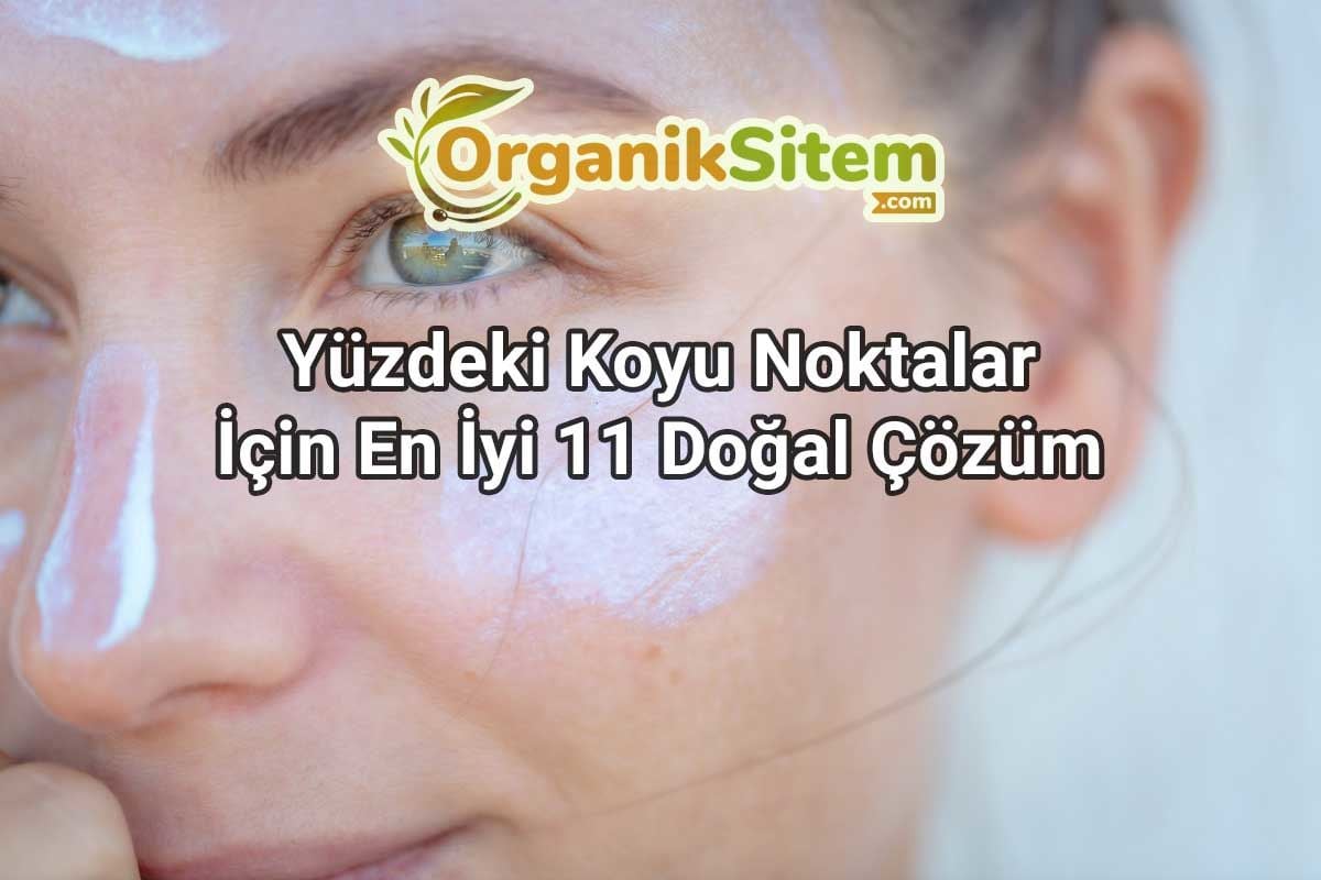 Yüzdeki Koyu Noktalar İçin En İyi 11 Doğal Çözüm