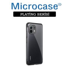 Microcase Xiaomi Mi 11 Lite - Mi 11 Youth Plating Series Soft Silikon Kılıf (SEÇENEKLİ)
