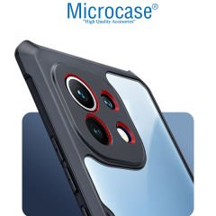 Microcase Xiaomi Mi 11 Youth Airbag Serisi Darbeye Dayanıklı Köşe Korumalı Kılıf
