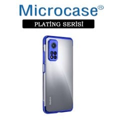 Xiaomi Mi 10T Plating Series Soft Silikon Kılıf - Mavi