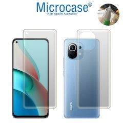 Microcase Xiaomi Mi 11 Lite - Mi 11 Youth Full Ön Arka Kaplama TPU Soft Koruma Filmi