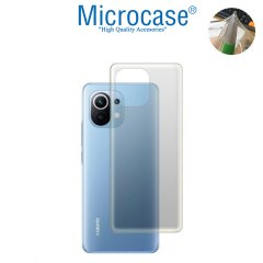 Microcase Xiaomi Mi 11 Lite - Mi 11 Youth Full Arka Kaplama TPU Soft Koruma Filmi
