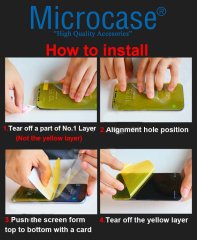 Microcase Huawei Mate 30 Lite Full Ön Kaplama Koruma Filmi
