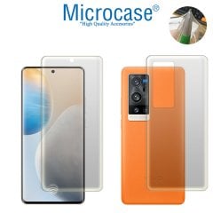 Microcase Vivo X60 Pro Plus Full Ön Arka Kaplama TPU Soft Koruma Filmi