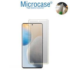 Microcase Vivo X60 Pro Plus Full Ön Kaplama TPU Soft Koruma Filmi