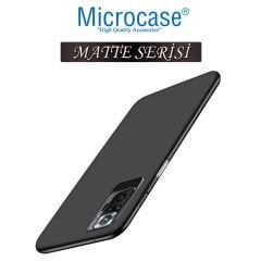 Microcase Xiaomi Redmi Note 10S Matte Serisi Silikon TPU Kılıf - Siyah