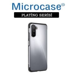 Microcase Huawei Mate 40 Lite Plating Series Soft Silikon Kılıf (SEÇENEKLİ)