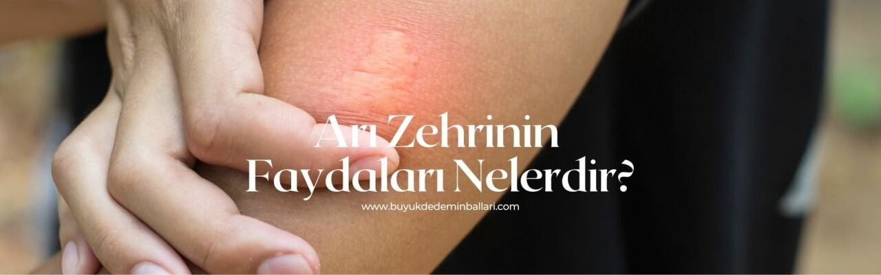 Arı Zehrinin Faydaları Nelerdir?