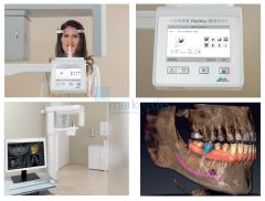 VistaVox S Ceph Dental Volumetrik Tomografi, Sefalometrik, Panoramik Röntgen Sistemi