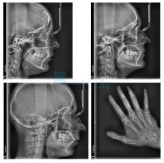 VistaVox S Ceph Dental Volumetrik Tomografi, Sefalometrik, Panoramik Röntgen Sistemi