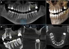 Orthophos S 3D Tomografi Cihazı