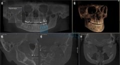 Axeos Tomografi Cihazı