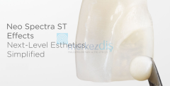 Neo Spectra ST Effects Estetik Kompozit Refill 3 gr