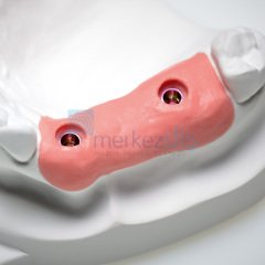 Gingifast Rigid Diş Eti Maskesi