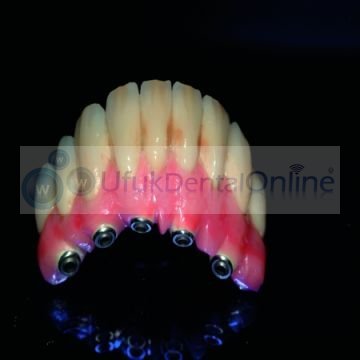 Gradia Gum Diş Eti Renk Sistemi