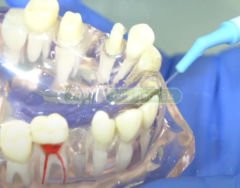 Cotisen Endodontik Aspirator Uç (20 Adet)