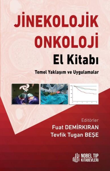 Jinekolojik Onkoloji El Kitabı: Temel Yaklaşım ve Uygulamalar