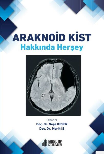 Araknoid Kist Hakkında Herşey