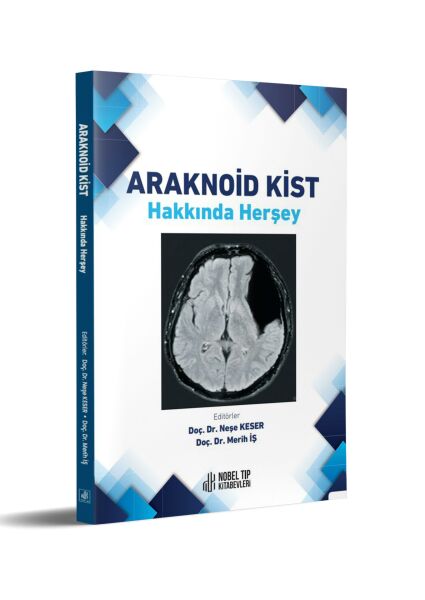 Araknoid Kist Hakkında Herşey