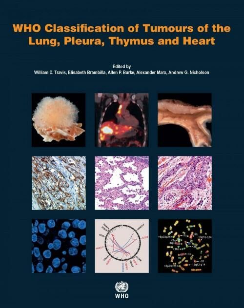 WHO Classification of Tumours of the Lung, Pleura,