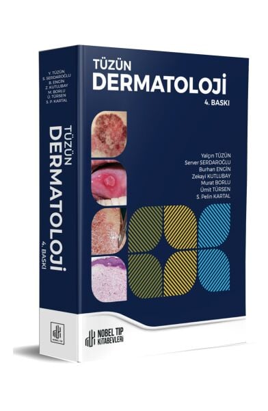 Tüzün Dermatoloji 4.Baskı