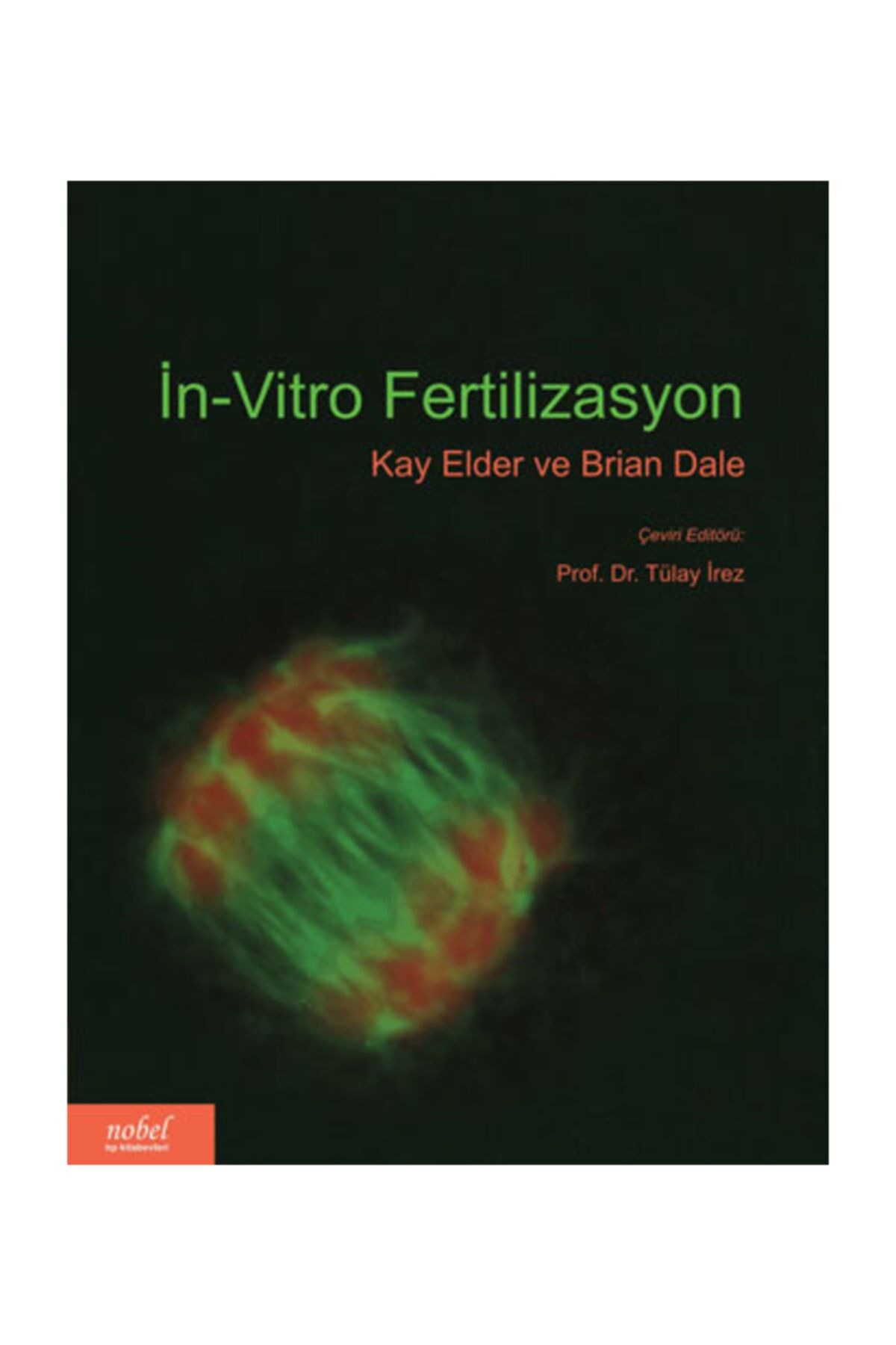 İn-Vitro Fertilizasyon