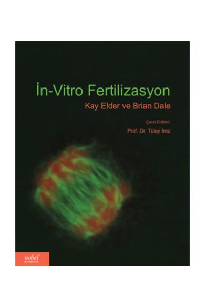 İn-Vitro Fertilizasyon
