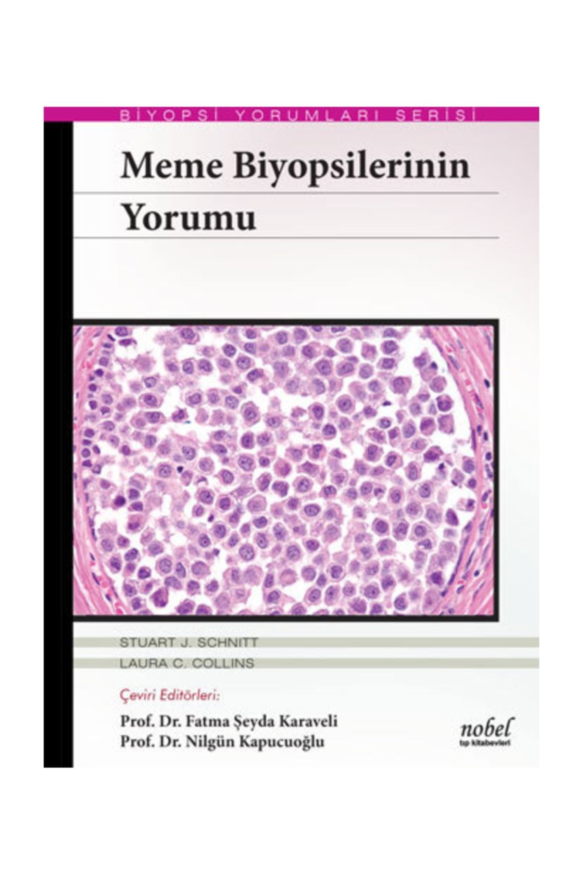 Meme Biyopsilerinin Yorumu - Biyopsi Yorumları Serisi