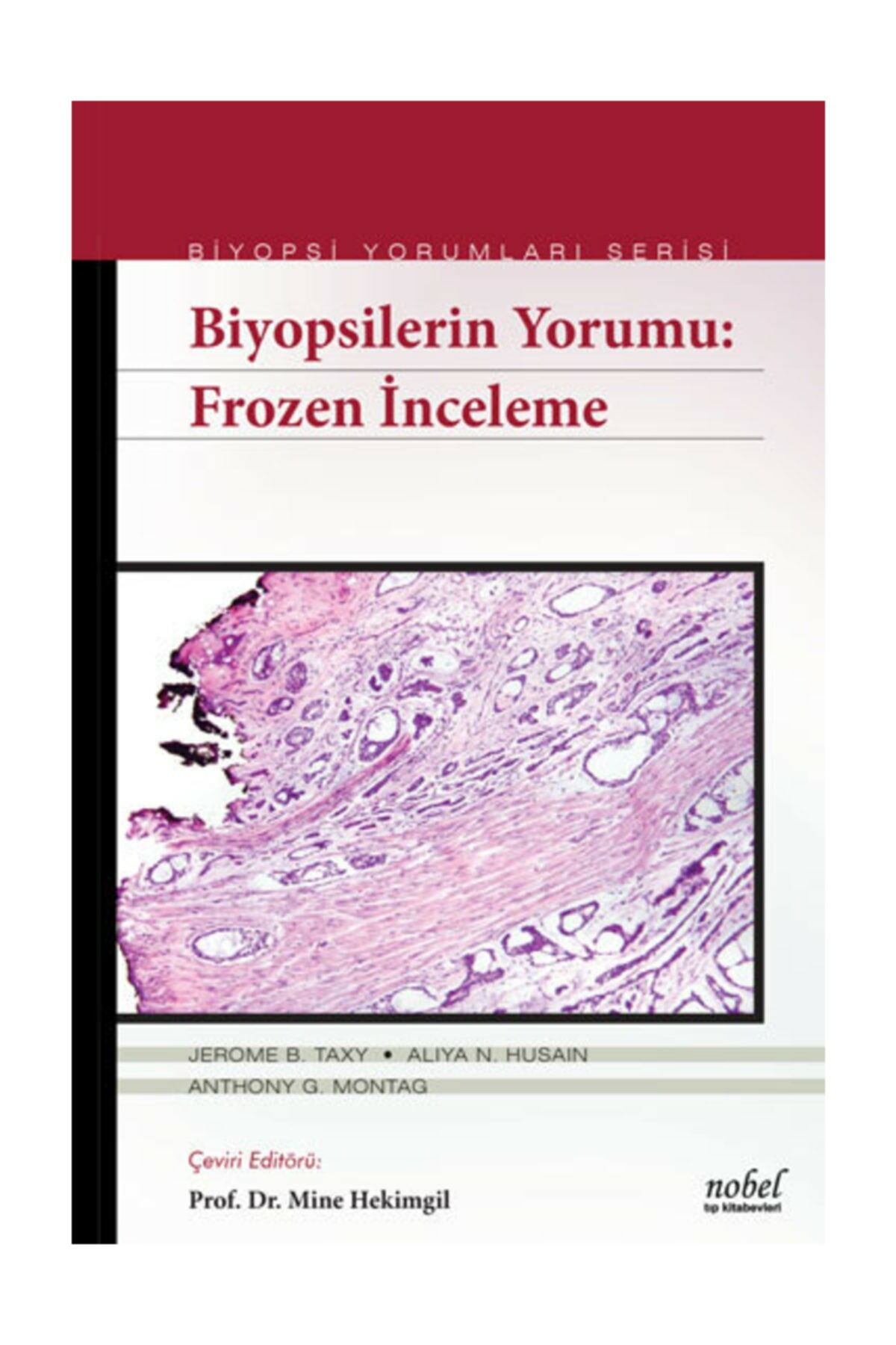 Biyopsilerin Yorumu: Frozen İnceleme - Biyopsi Yorumları Serisi