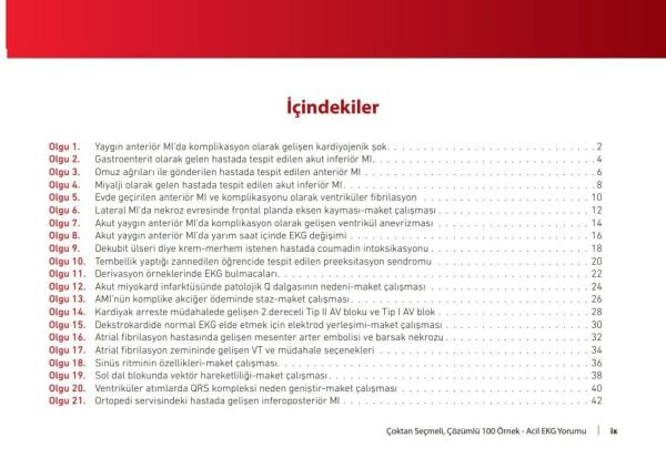 Çoktan Seçmeli Çözümlü 100 Örnek Acil EKG Yorumu