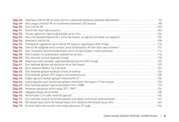Çoktan Seçmeli Çözümlü 100 Örnek Acil EKG Yorumu