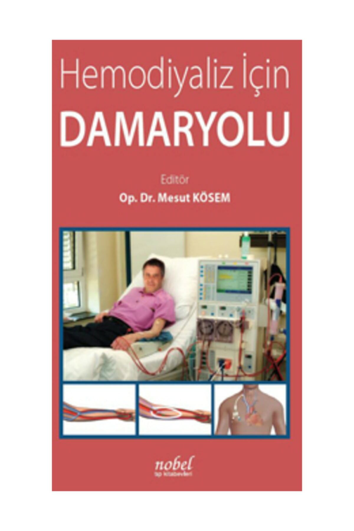 Hemodiyaliz İçin Damaryolu