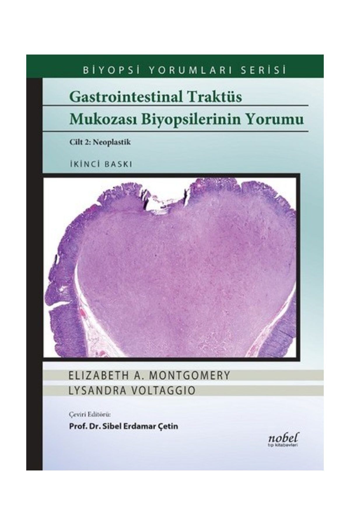Gastrointestinal Traktüs Mukozası Biyopsilerinin Yorumu Cilt 2: Neoplastik - Biyopsi Yorumları Serisi