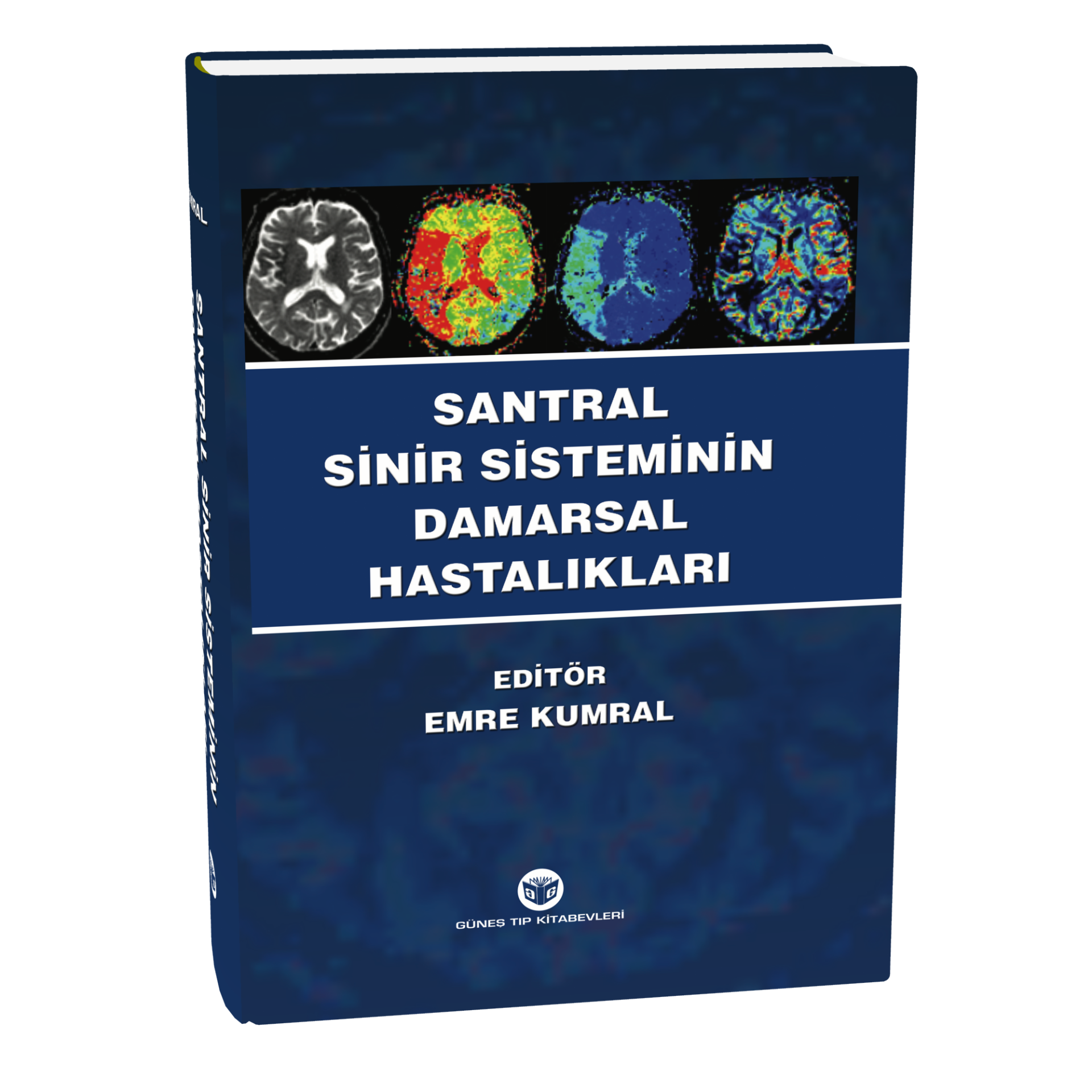 Santral Sinir Sisteminin Damarsal Hastalıkları