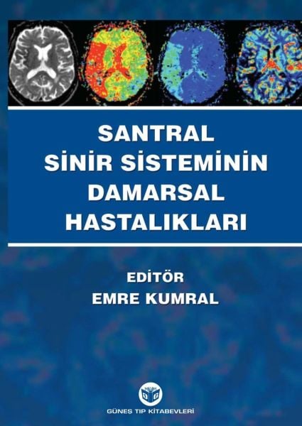 Santral Sinir Sisteminin Damarsal Hastalıkları