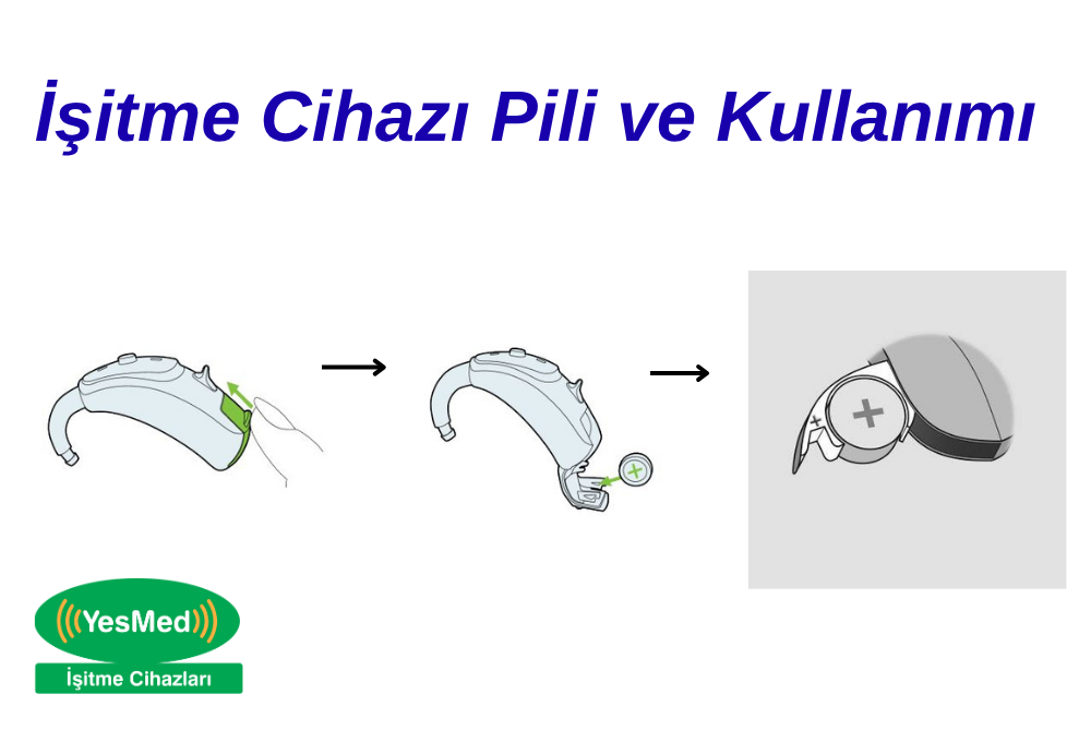 İŞİTME CİHAZI PİLİ VE KULLANIMI
