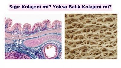 Sığır Kolajeni Mi Yoksa Balık Kolajeni Mi?